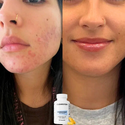 De piel opaca a glow natural